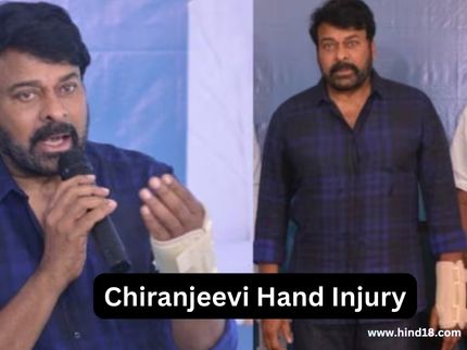 Chiranjeevi Hand Injury