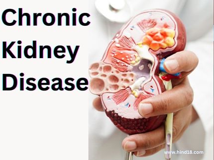 Chronic Kidney Disease